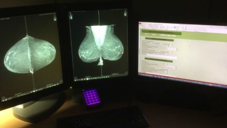 Improving radiologic technologist performance in breast cancer screening: impact of a training course